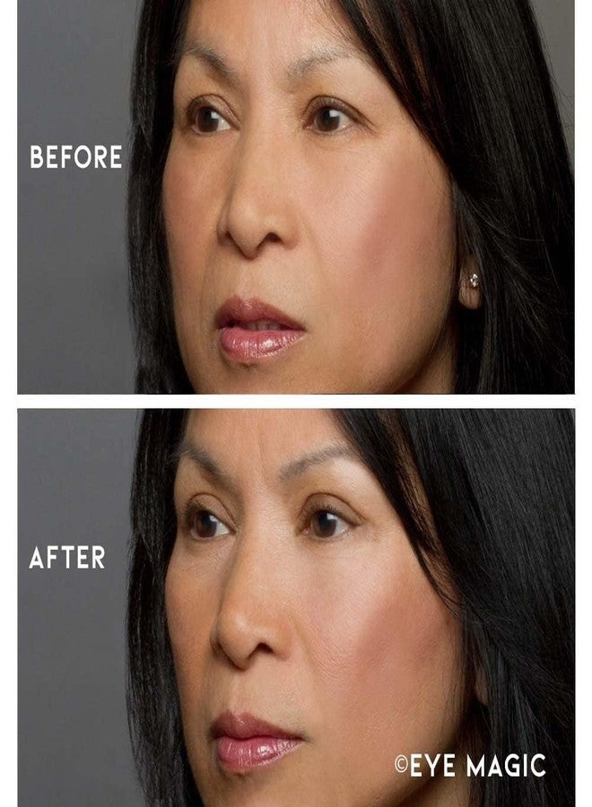 Eye Magic Premium Instant Eyelid Lift (L/XL-Refill). Look Younger Instantly | Made in America - Lifts and Defines Droopy, Sagging, Hooded Eyelids For A Youthful Look - Image 3